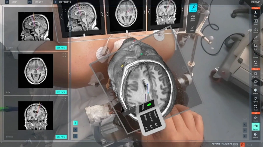 Medivis SurgicalAR